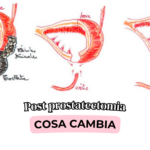 Problemi sessuali dopo prostatectomia: cosa succede e quale ruolo ha la fisioterapia